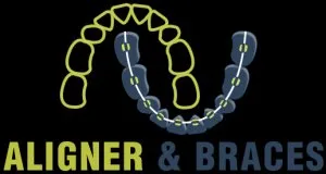 Cost of braces for teeth in delhi - aligner & braces