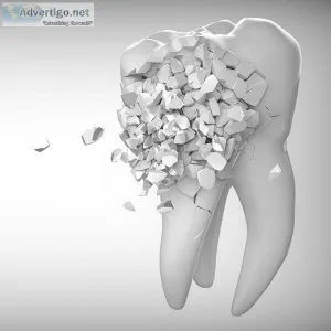 Dental clinic in coimbatore | cosmetic dental clinic 