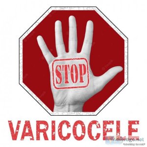 Varicose veins treatment in kolkata at no-cost emi