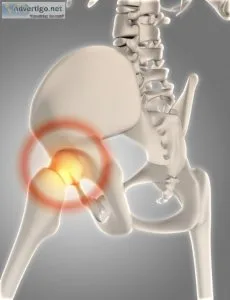 Types of hip replacement surgeries and their costs