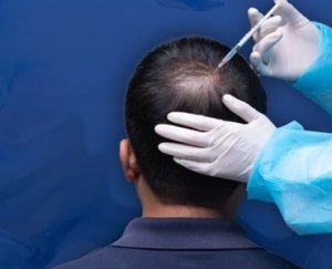 Permanent skin whitening treatment cost in bangalore - skin ligh
