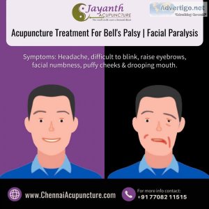 Acupuncture treatment in chennai