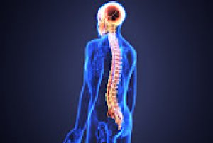 Permanent cure for lumbar spondylosis