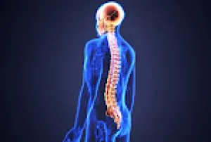 Permanent cure for lumbar spondylosis