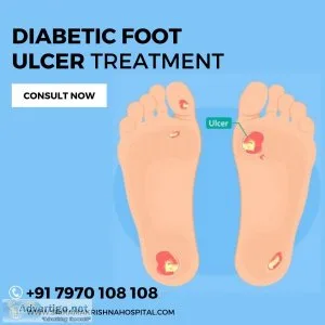 Diabetic wound treatment in coimbatore