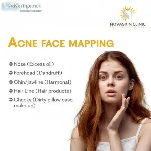 The novaskin clinic (best skin, hair, laser and aesthetic clinic