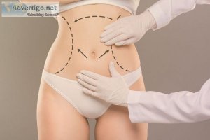 Tummy tuck surgery in dubai | dr anshu mishra