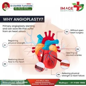 Angioplasty treatment in ameerpet