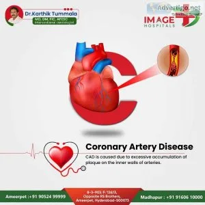 Heart specialist in ameerpet