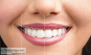 Digital smile design