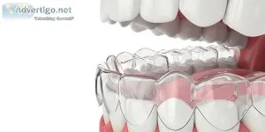 Invisalign dentist in new york city