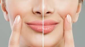 Cosmetic injectable treatments in dubai