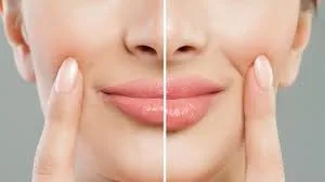 Cosmetic injectable treatments in dubai