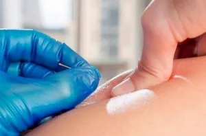 About ims/dry needling therapy