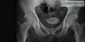 Dr niren rao: a well-known bladder stone specialist in delhi