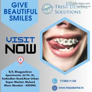 Best braces treatment | expert dentist dr rohan virani mulund