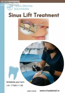 Sinus Lift Dental Surgery, Mumbai India |  Trisa Dental Solution