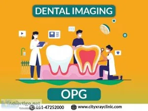 Best opg scan provider in delhi at best price