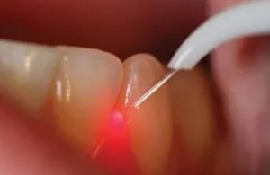 Best cosmetic dentist in hyderabad