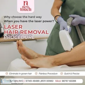 Laser hair removal treatment in ahmedabd