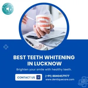 Best teeth whitening in lucknow