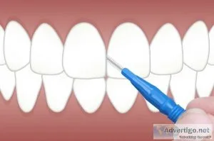 Restore your smile with dental implants