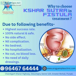 Advanced ksharsutra for fissure treatment in chandigarh