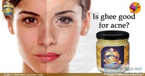 Is ghee good for acne?