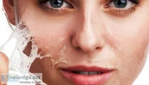 chemical peel treatment at The Daily Aesthetics clinic in Pune