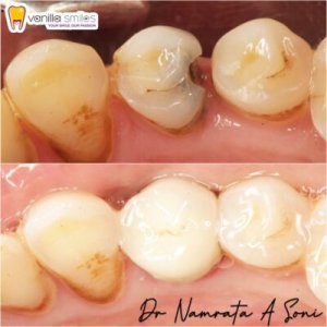 Vanilla smile: your ultimate destination for the best dental cro