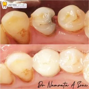 Vanilla smile: your ultimate destination for the best dental cro