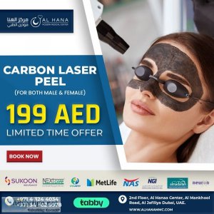 Carbon laser peel