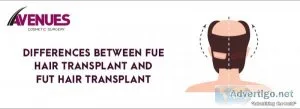 Differences between fue and fut hair transplant