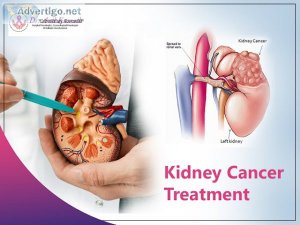 Kidney cancer treatment in banashankari, bannerghatta road