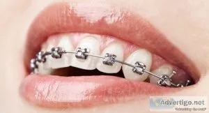 Orthodontic treatment in jogeshwari, mumbai