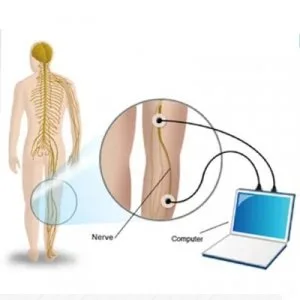 Ncv test price in delhi