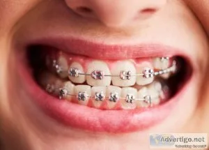 Best dental clinic in dubai