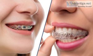 Invisalign in pune shivaji nagar| invisible braces cost in pune