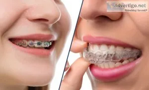 Invisalign in pune shivaji nagar| invisible braces cost in pune