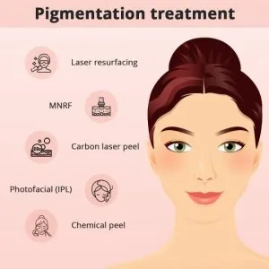 Pigmentation treatment in hyderabad