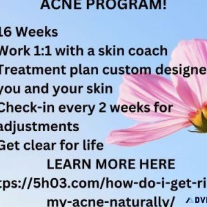 How do i get rid of my acne naturally