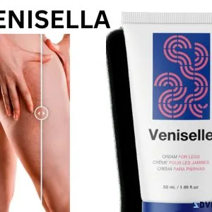 Veniselle treatmrnt for varicose veins