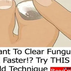 Want To Clear Fungus 3X Faster Try THIS Odd Technique
