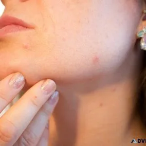 Rehydrate and Heal Your Skin. After Care and Daily Care