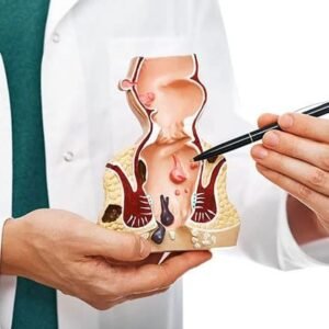 Find piles doctor in ghaziabad