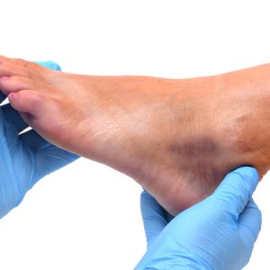 12 top orthopedic surgery hospitals in india
