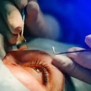 Cornea transplant in delhi india