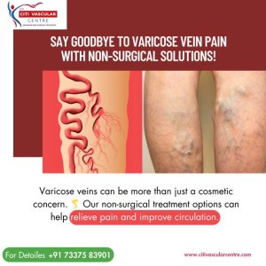 Best varicose veins hospital in hyderabad