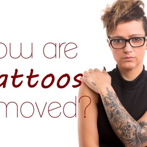 Permanent laser tattoo removal