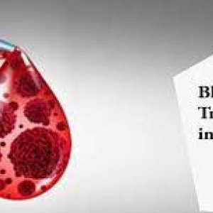 Blood cancer treatment cost in india